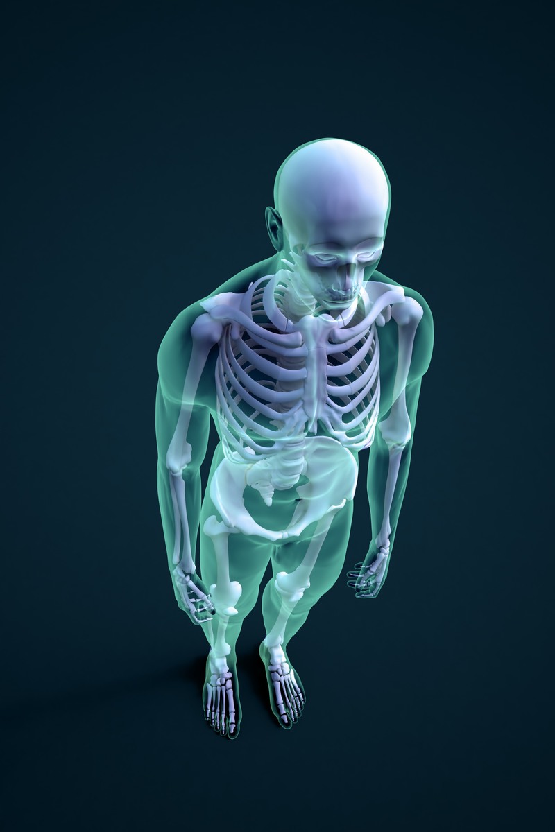 人体骨骼透视医学影像
